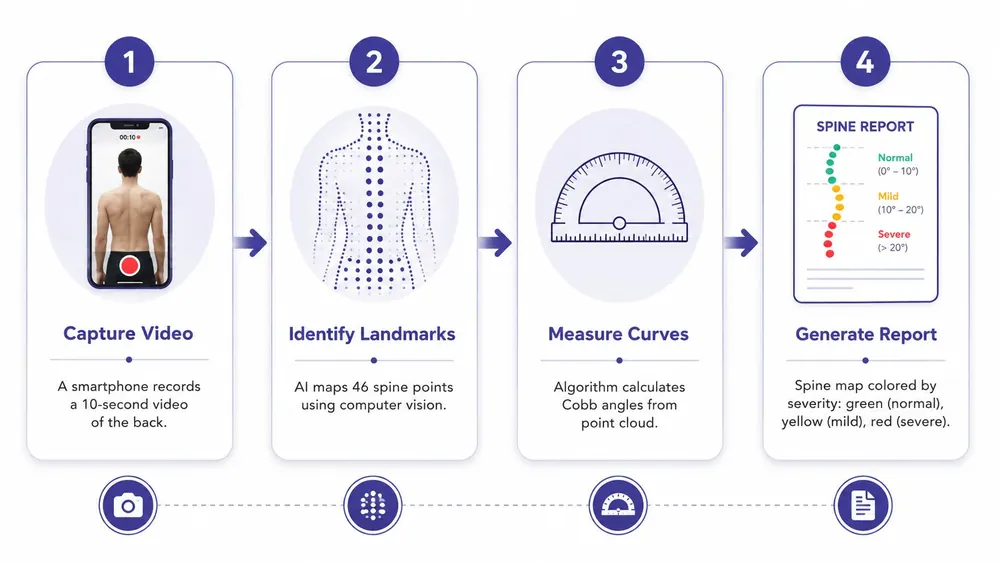 A four-step infographic illustrating an AI-powered smartphone application process for scoliosis screening and spinal health assessment.