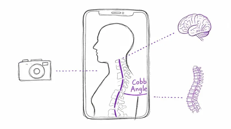 Posture Analysis Tool Online: Clinical Guide & Selection