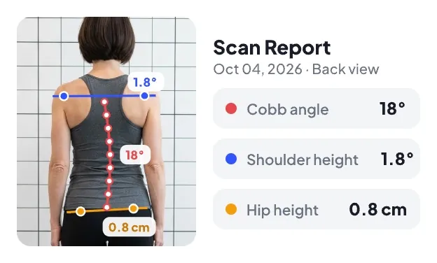 Back-view scan with the detected spine curve, shoulder line and hip line marked