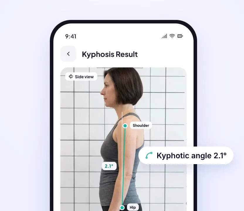 Side-view photo with the shoulder-to-hip line and a 2.1° kyphotic angle