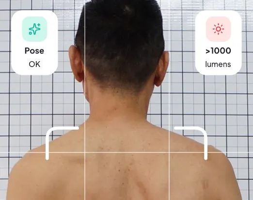 Posture scan using only the phone camera
